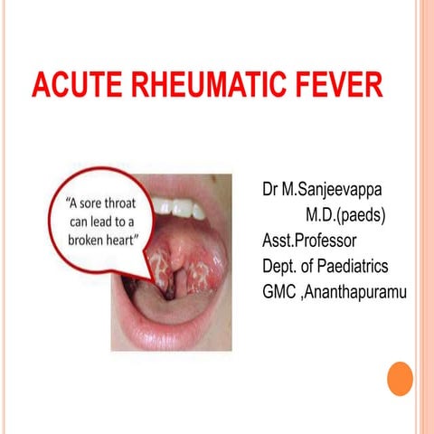 Acute rheumatic fever