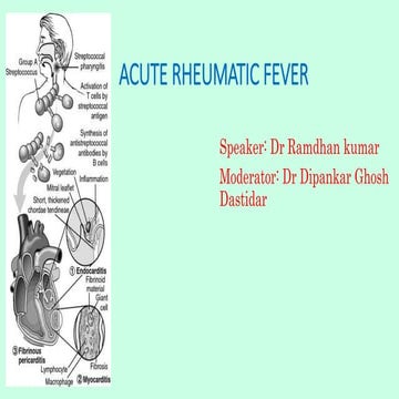 Acute rheumatic fever 