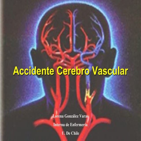 acv accidente cerebrovascular introducción | PPTX