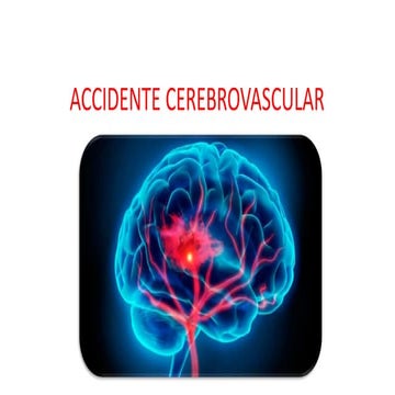 ACV NEUROLOGÍA