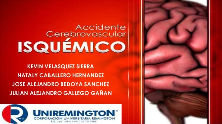 Pautas de hipertensión post accidente cerebrovascular isquémico Pautas de hipertensión post accidente cerebrovascular isquémico