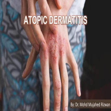 Comprehensive Overview of Atopic Dermatitis: Pathogenesis, Clinical ...