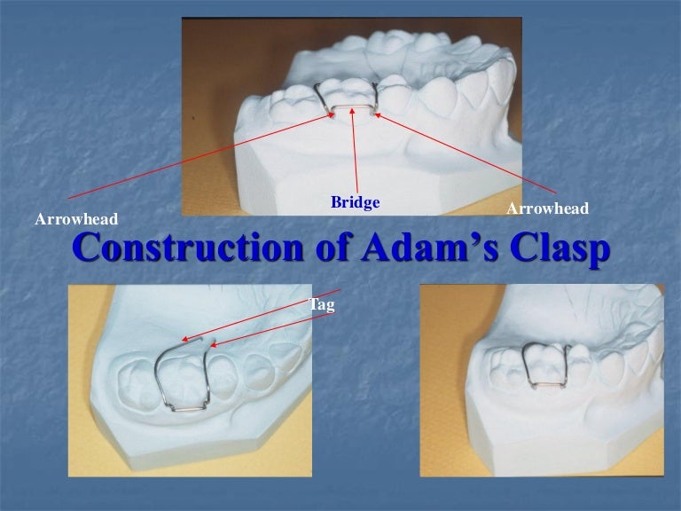 Adam's clasp