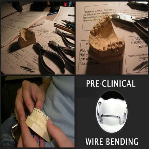 Adams Clasp Construction.pptx Adams Clasp Construction.pptx