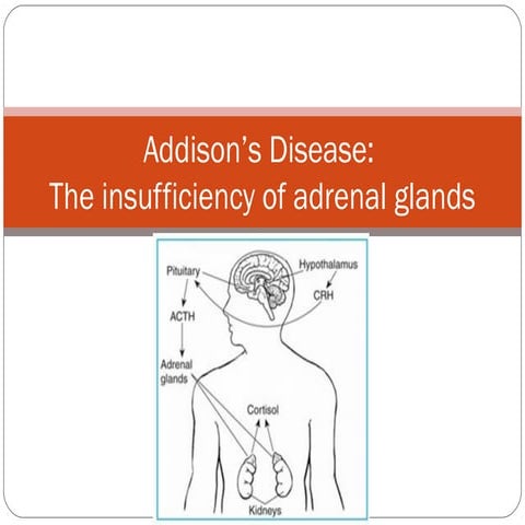 Addison’s disease