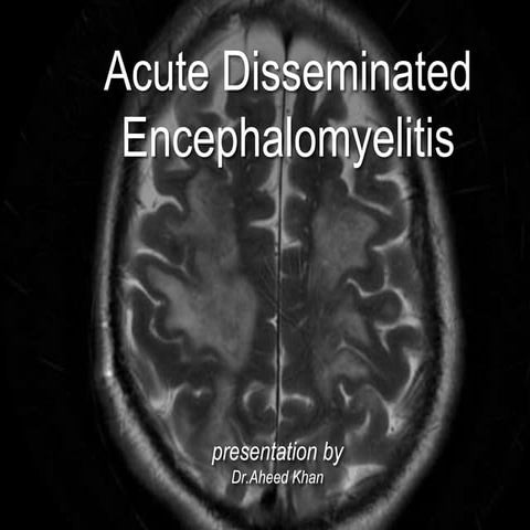 Acute Disseminated Encephalomyelitis
