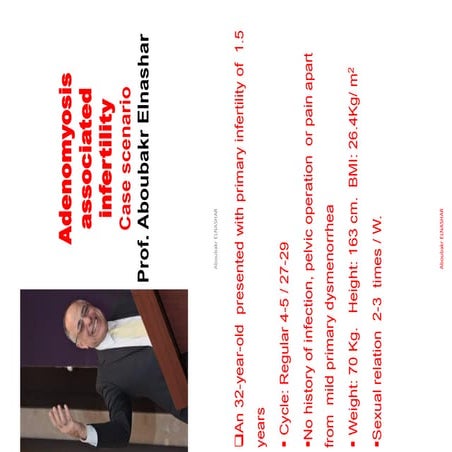 Adenomyosis associated  infertility