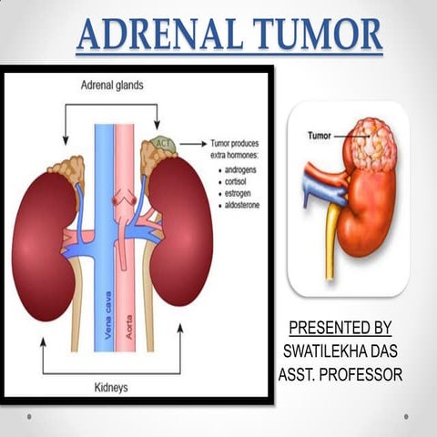 Adrenal tumor, classification, management - easy explanation | PDF