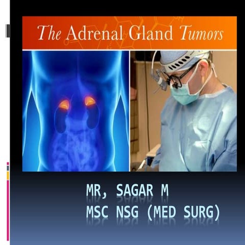 Adrenal tumour