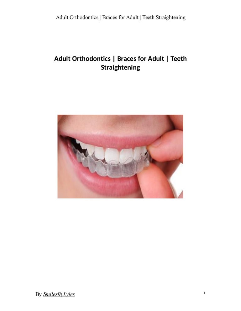 permanent teeth straightening