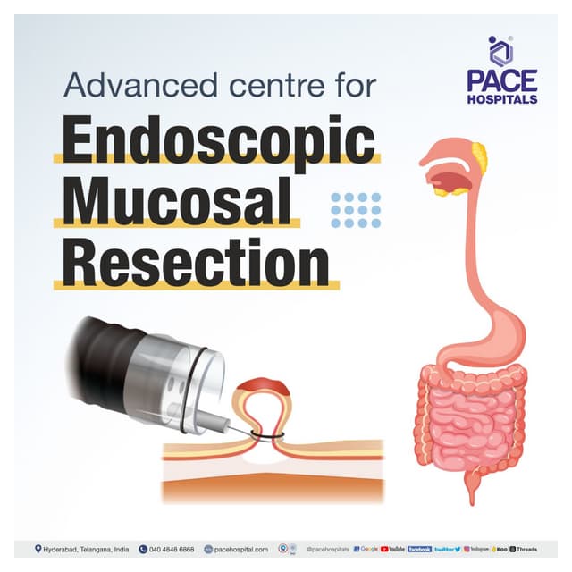 Endoscopic Mucosal Resection (EMR) Procedure Indications & Cost PDF