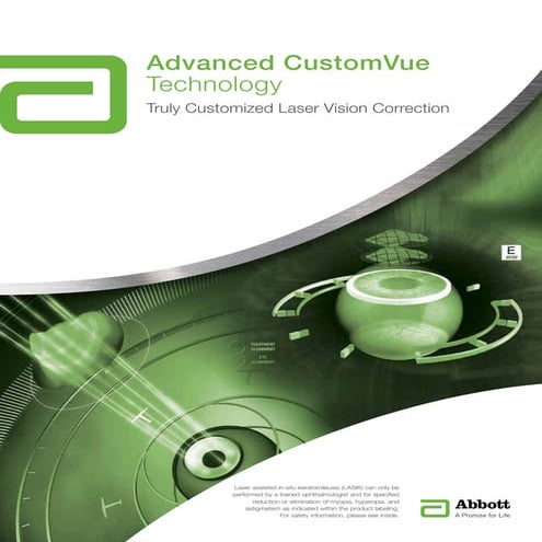 ParkAvenueLasek.com - iAdvanced CustomVue Technology - Truly Customized Laser...