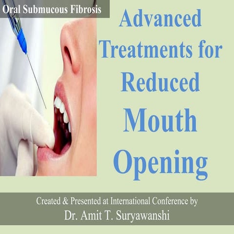 ORAL SUBMUCOUS FIBROSIS (OSMF) | PPTX