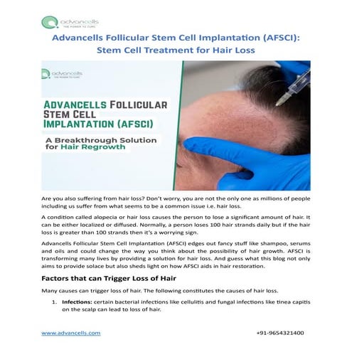 Advancells Follicular Stem Cell Implantation (AFSCI) for Hair Loss