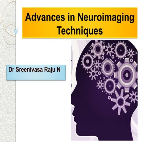 Advances in neuroimaging techniques