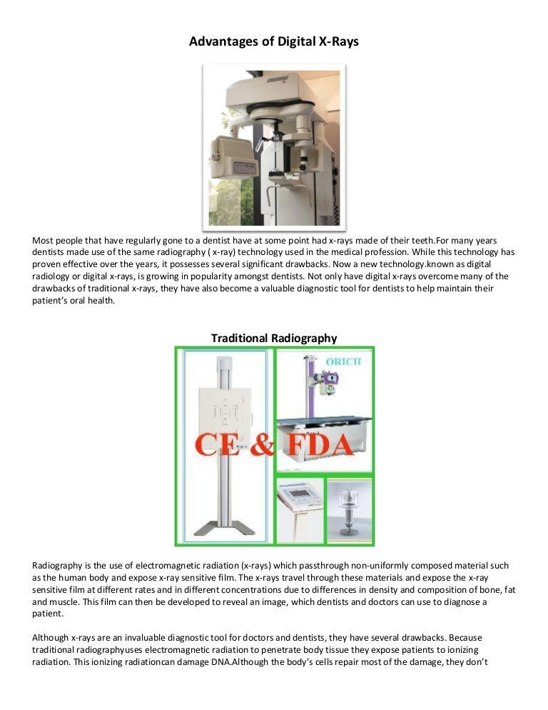 Advantages of digital x rays