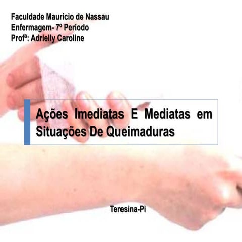 Ações imediatas e mediatas em situações de queimaduras | PPTX