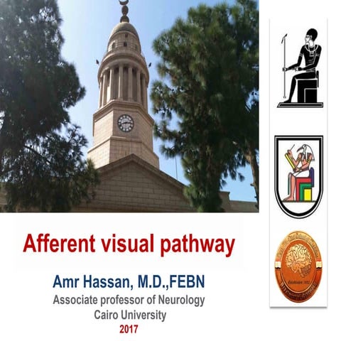 Afferent visual pathway