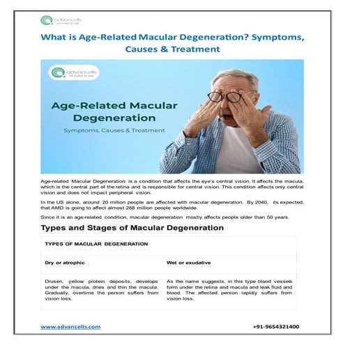 What is Age-Related Macular Degeneration?
