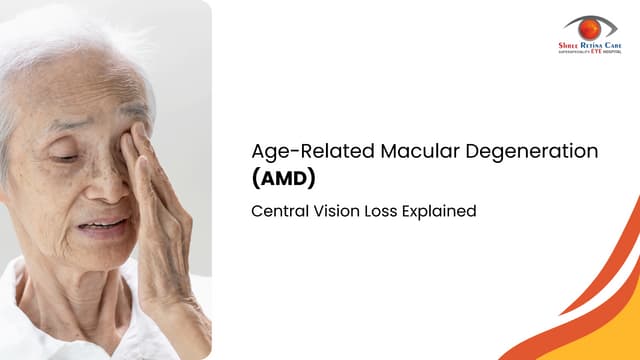 Symptoms of Macular Degeneration and Age-Related Macular Degeneration ...
