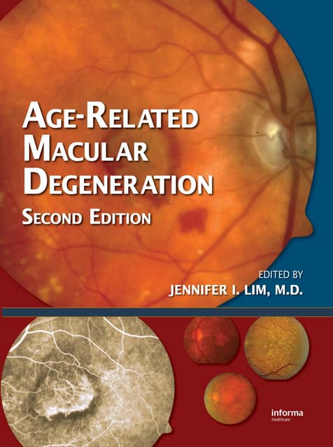 Age related macular degeneration | PPTX
