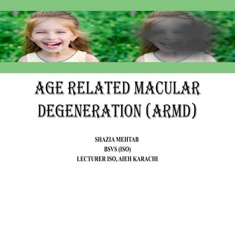 Age Related Macular Degeneration (ARMD).pptx