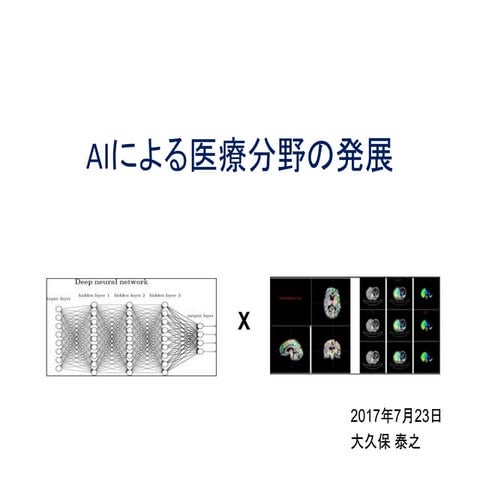 Aiによる医療分野の発展