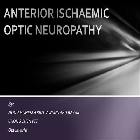 AION Anterior Ischemic Optic Neuropathy