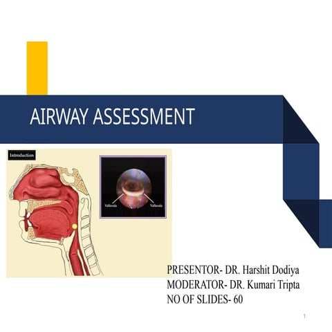 Airway Assessment1.pptxghhhghjkkkkfhhhjjjj