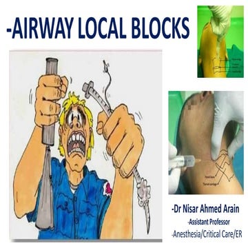 Airway local blocks