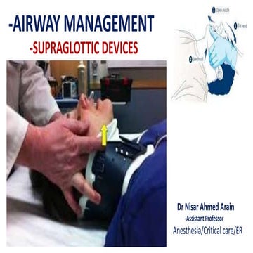 Airway management