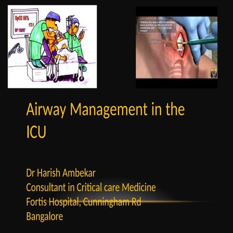 Airway_Management ICU (1).pptx for critical care patients