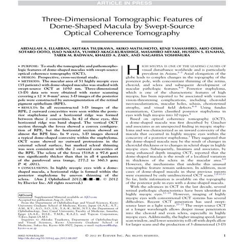 3D Tomgraphic features in dome shaped macula by swept source OCT