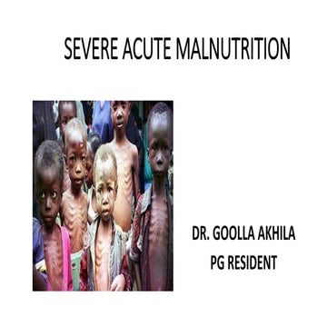 Severe acute malnutrition presentation ppt