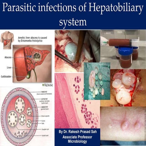 Amoebic Liver abscess & Hydatid Disease.pptx