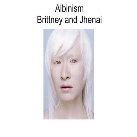 Albinismbj