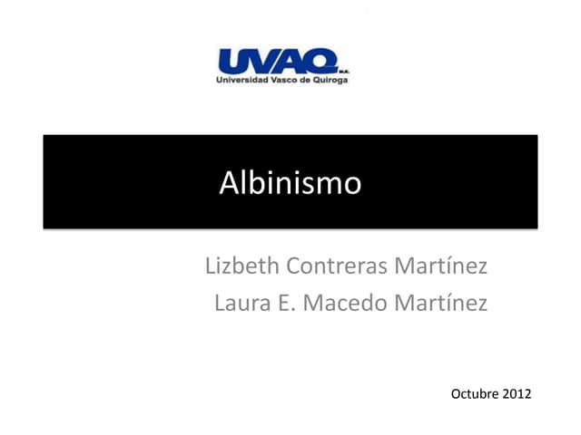 Albinismo