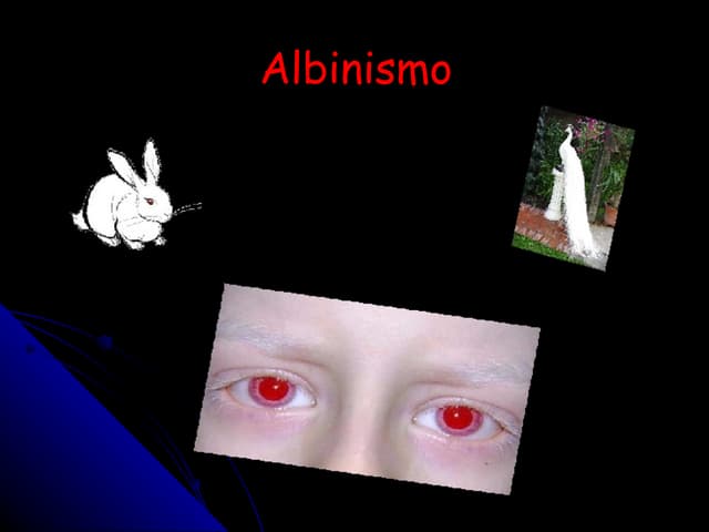 Albinismo 2