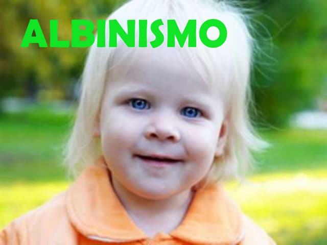 Albinismo (2)
