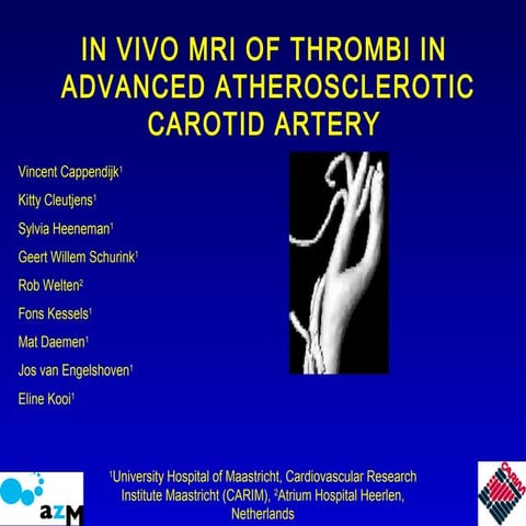 In vivo mri of thrombi in advanced atherosclerosis