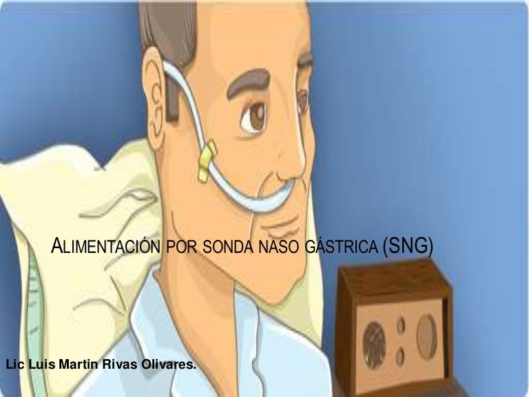 Alimentación por sonda naso gástrica (sng)