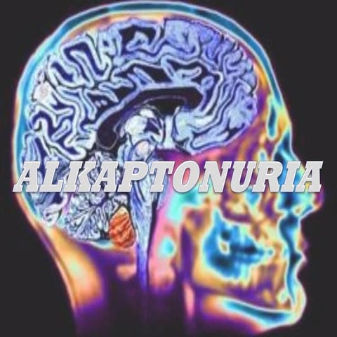 Alkaptonuria