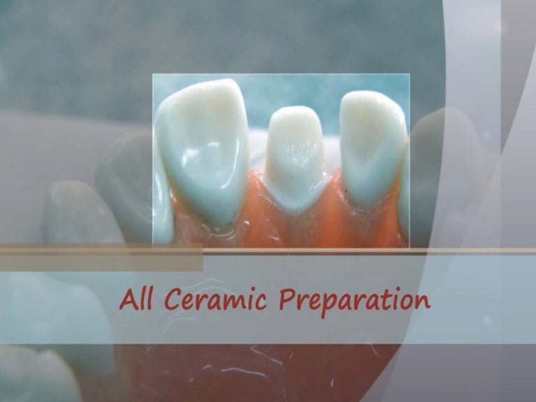 All ceramic crown preparation seminar