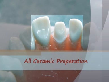 All ceramic crown preparation seminar