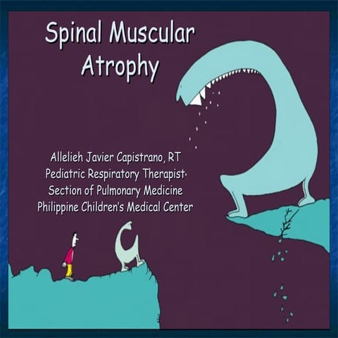 spinal muscular atrophy sma by allelieh
