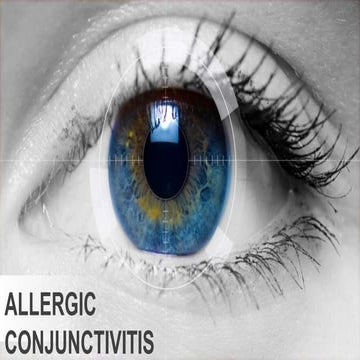 Allergic conjuctivitis