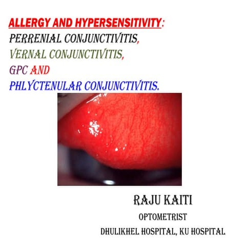 ALLERGY AND HYPERSENSITIVITY: PERRENIAL CONJUNCTIVITIS, VERNAL ...