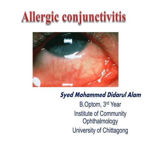 Allergic conjunctivitis