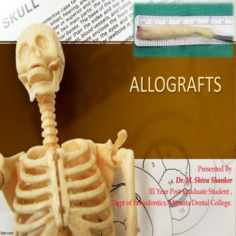 Allograft