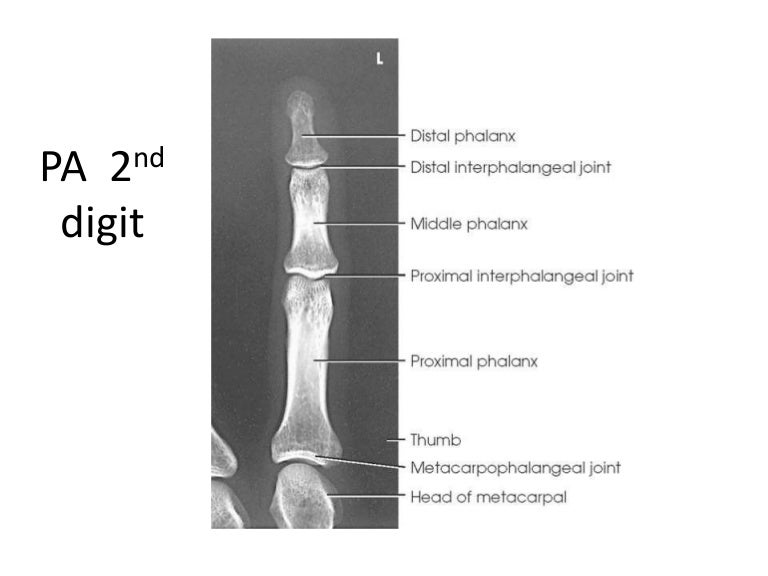 All projections Anatomy